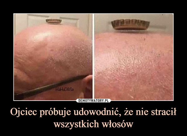 Ojciec próbuje udowodnić, że nie stracił wszystkich włosów –  