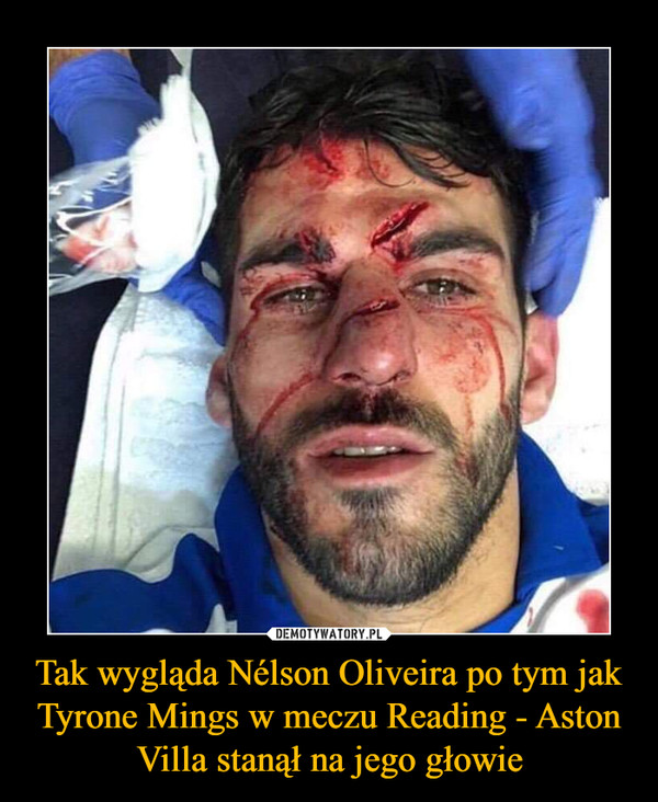 Tak wygląda Nélson Oliveira po tym jak Tyrone Mings w meczu Reading - Aston Villa stanął na jego głowie